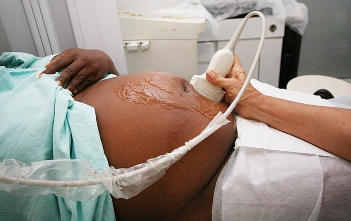 Casos de HIV em grávidas negras e pardas aumentou 64,4% em dez anos