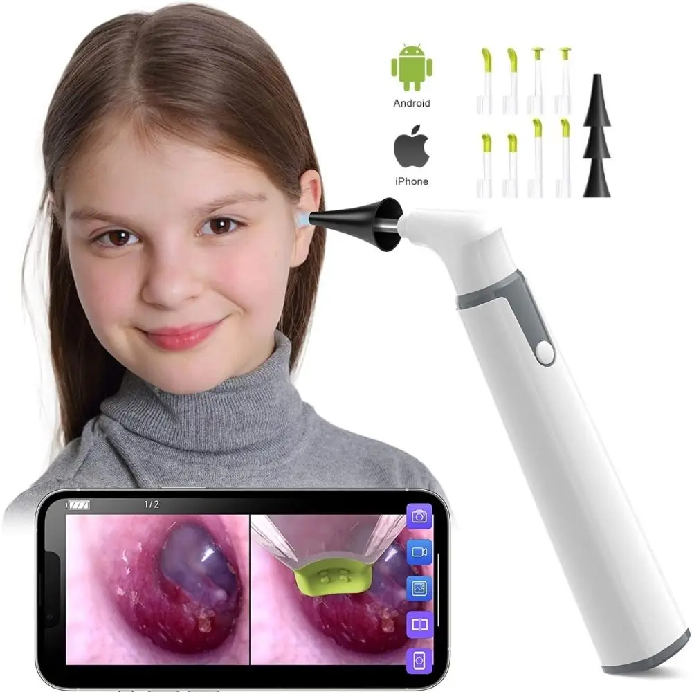 Câmera de inspeção de limpeza de ouvido, otoscópio digital wi-fi, 3.9mm, ferramentas de remoção de cera de ouvido para iphone e android Câmera de inspeção de limpeza de ouvido, otoscópio digital wi-fi, 3.9mm, ferramentas de remoção de cera de ouvido para iphone e android