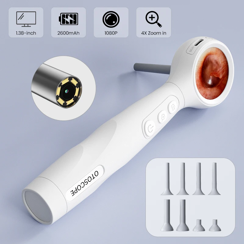 Câmera Otoscópio Visual com Tela de 1.38'' Digital HD1080P, Ferramenta de Remoção de Cera de Ouvido com 6 LEDs para Adultos e Crianças